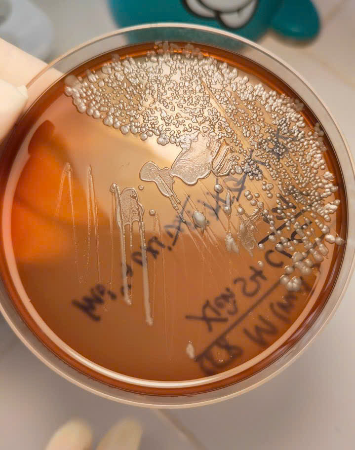 Hình ảnh tin tức CẢNH GIÁC VỚI VI KHUẨN “ĂN THỊT NGƯỜI” WHITMORE 